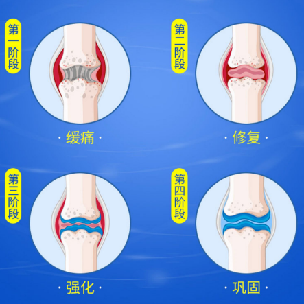 氨糖软骨素钙片有哪些副作用？科学养护关节就看这篇！