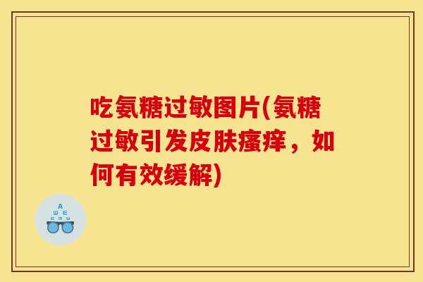 吃氨糖过敏图片(氨糖过敏引发皮肤瘙痒，如何有效缓解)