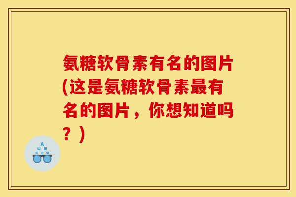 氨糖软骨素有名的图片(这是氨糖软骨素最有名的图片，你想知道吗？)