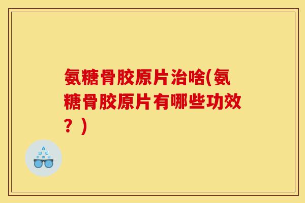 氨糖骨胶原片治啥(氨糖骨胶原片有哪些功效？)