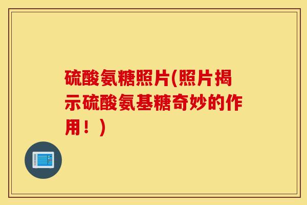 硫酸氨糖照片(照片揭示硫酸氨基糖奇妙的作用！)