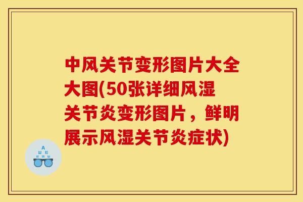 中风关节变形图片大全大图(50张详细风湿关节炎变形图片，鲜明展示风湿关节炎症状)