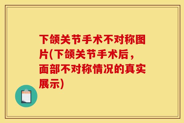 下颌关节手术不对称图片(下颌关节手术后，面部不对称情况的真实展示)