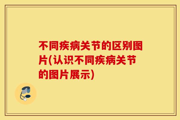 不同疾病关节的区别图片(认识不同疾病关节的图片展示)
