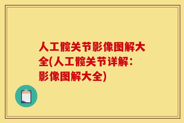 人工髋关节影像图解大全(人工髋关节详解：影像图解大全)