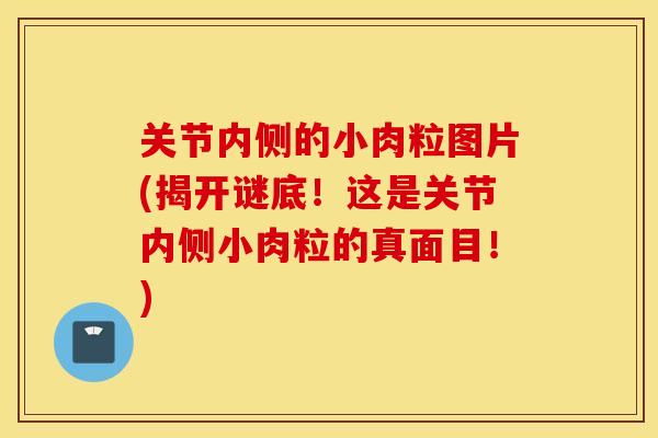 关节内侧的小肉粒图片(揭开谜底！这是关节内侧小肉粒的真面目！)