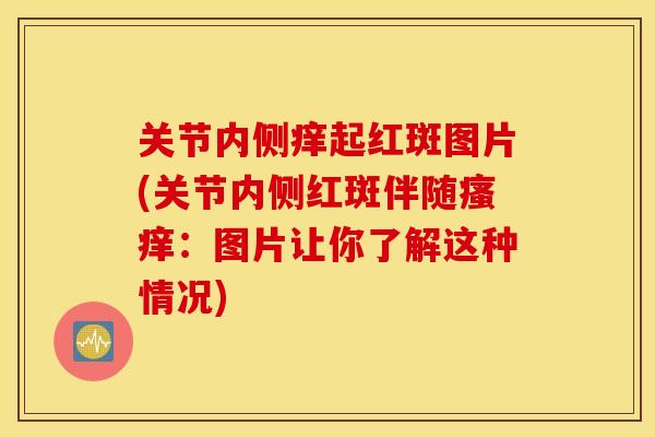 关节内侧痒起红斑图片(关节内侧红斑伴随瘙痒：图片让你了解这种情况)