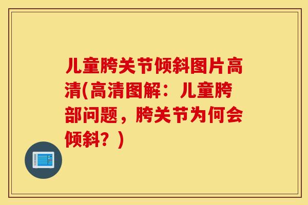 儿童胯关节倾斜图片高清(高清图解：儿童胯部问题，胯关节为何会倾斜？)