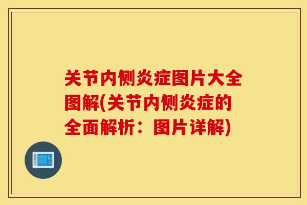 关节内侧炎症图片大全图解(关节内侧炎症的全面解析:图片详解) 关节内侧炎症图片大全图解(关节内侧炎症的全面解析:图片详解)
