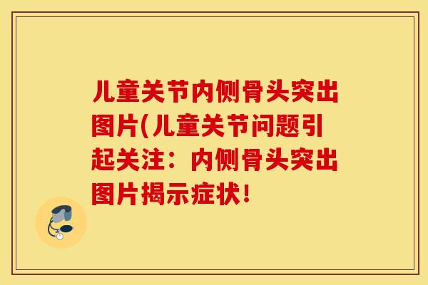 儿童关节内侧骨头突出图片(儿童关节问题引起关注：内侧骨头突出图片揭示症状！