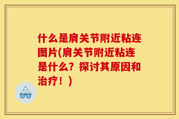 什么是肩关节附近粘连图片(肩关节附近粘连是什么？探讨其原因和治疗！)