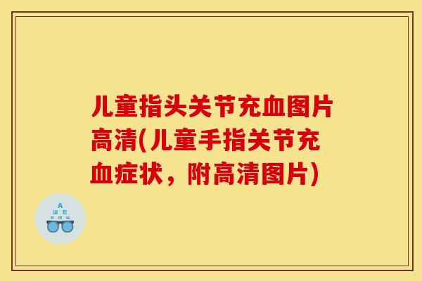 儿童指头关节充血图片高清(儿童手指关节充血症状，附高清图片)
