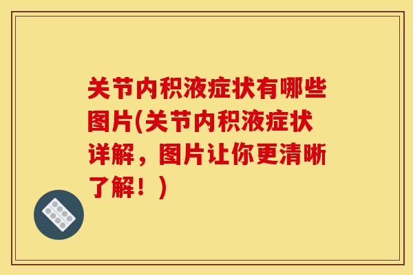 关节内积液症状有哪些图片(关节内积液症状详解，图片让你更清晰了解！)