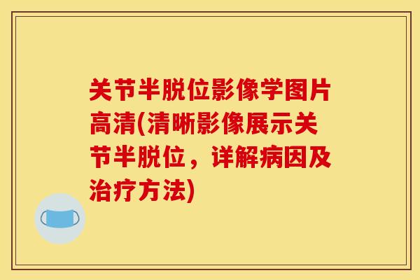 关节半脱位影像学图片高清(清晰影像展示关节半脱位，详解病因及治疗方法)