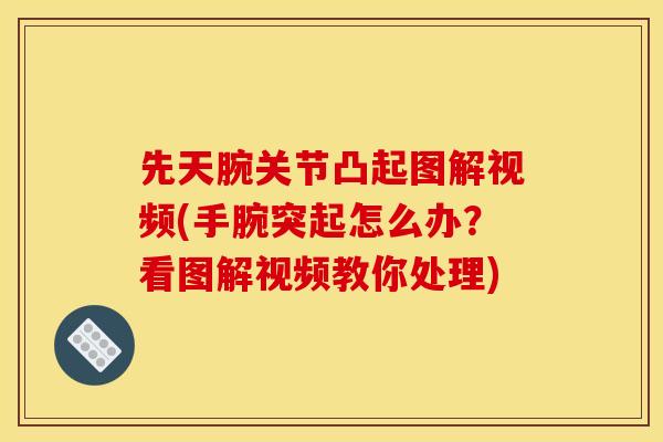 先天腕关节凸起图解视频(手腕突起怎么办？看图解视频教你处理)