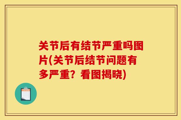 关节后有结节严重吗图片(关节后结节问题有多严重？看图揭晓)
