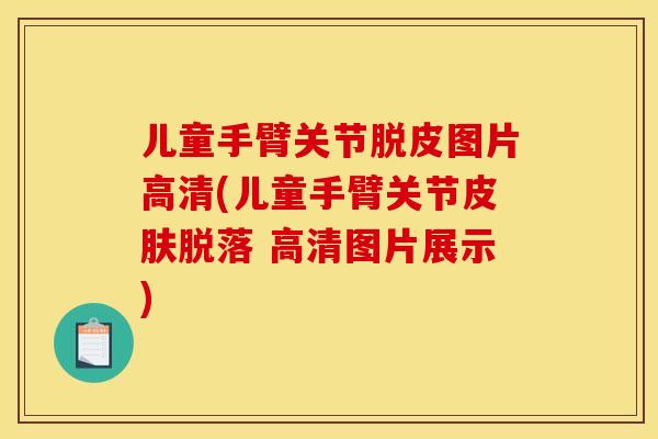 儿童手臂关节脱皮图片高清(儿童手臂关节皮肤脱落 高清图片展示) 儿童手臂关节脱皮图片高清(儿童手臂关节皮肤脱落 高清图片展示)