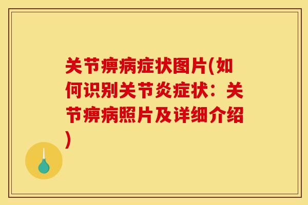关节痹病症状图片(如何识别关节炎症状：关节痹病照片及详细介绍)