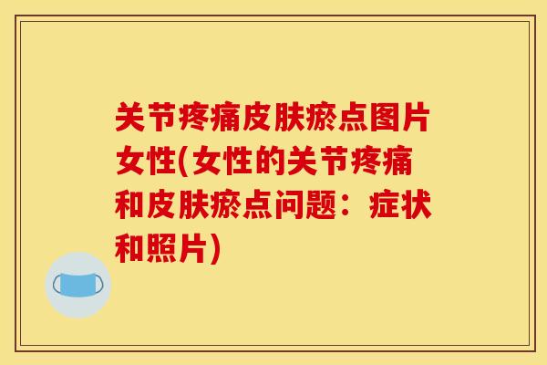 关节疼痛皮肤瘀点图片女性(女性的关节疼痛和皮肤瘀点问题：症状和照片)