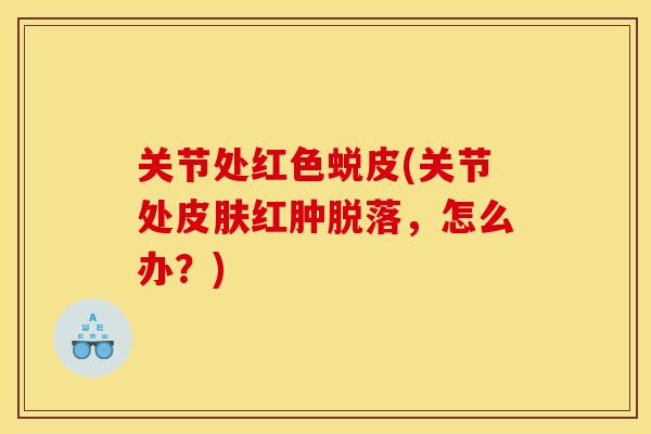 关节处红色蜕皮(关节处皮肤红肿脱落，怎么办？)