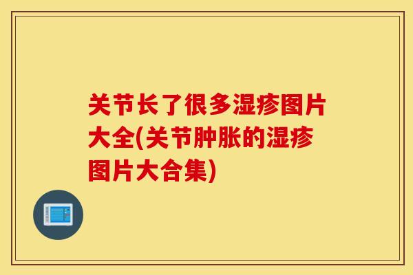 关节长了很多湿疹图片大全(关节肿胀的湿疹图片大合集)