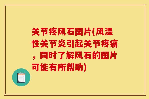 关节疼风石图片(风湿性关节炎引起关节疼痛，同时了解风石的图片可能有所帮助)