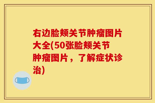 右边脸颊关节肿瘤图片大全(50张脸颊关节肿瘤图片，了解症状诊治)