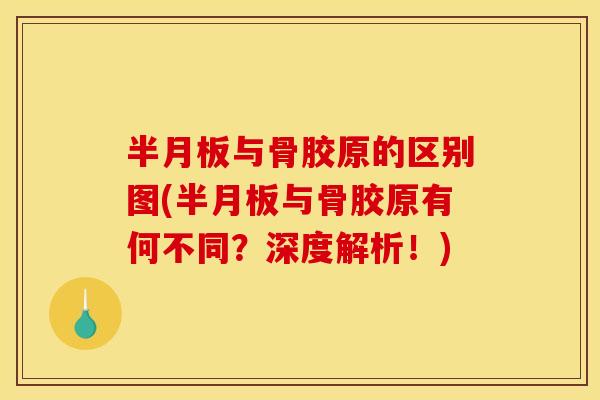 半月板与骨胶原的区别图(半月板与骨胶原有何不同？深度解析！)