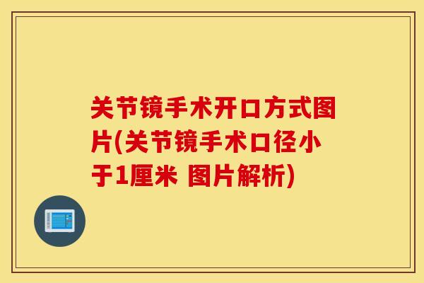 关节镜手术开口方式图片(关节镜手术口径小于1厘米 图片解析)