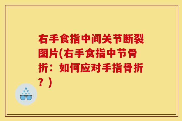 右手食指中间关节断裂图片(右手食指中节骨折：如何应对手指骨折？)
