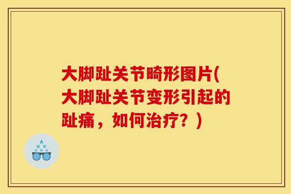 大脚趾关节畸形图片(大脚趾关节变形引起的趾痛，如何治疗？)