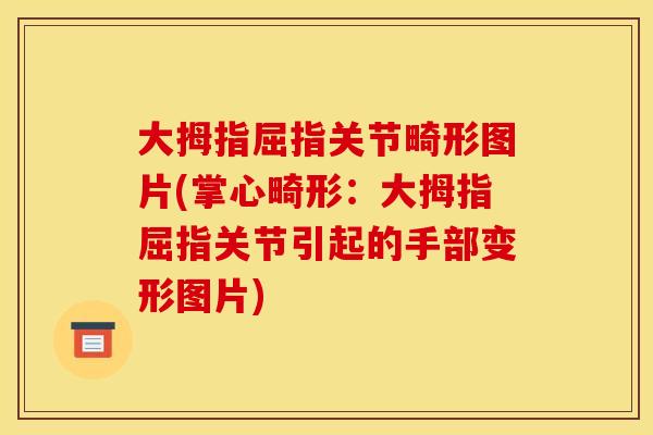 大拇指屈指关节畸形图片(掌心畸形：大拇指屈指关节引起的手部变形图片)