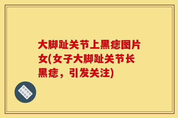 大脚趾关节上黑痣图片女(女子大脚趾关节长黑痣，引发关注)