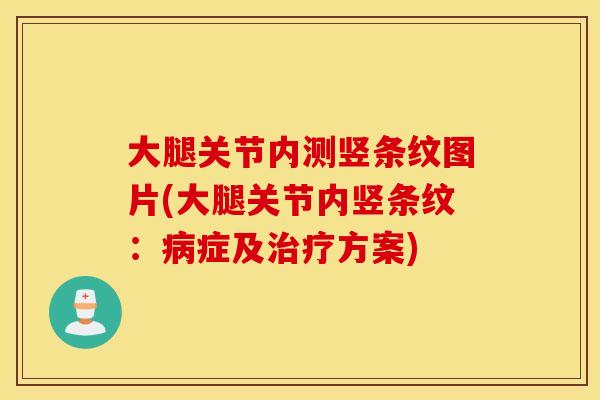 大腿关节内测竖条纹图片(大腿关节内竖条纹：病症及治疗方案)