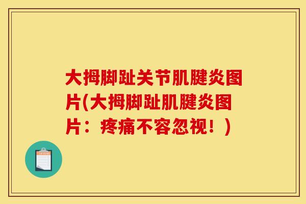 大拇脚趾关节肌腱炎图片(大拇脚趾肌腱炎图片：疼痛不容忽视！)