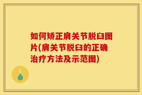 如何矫正肩关节脱臼图片(肩关节脱臼的正确治疗方法及示范图)