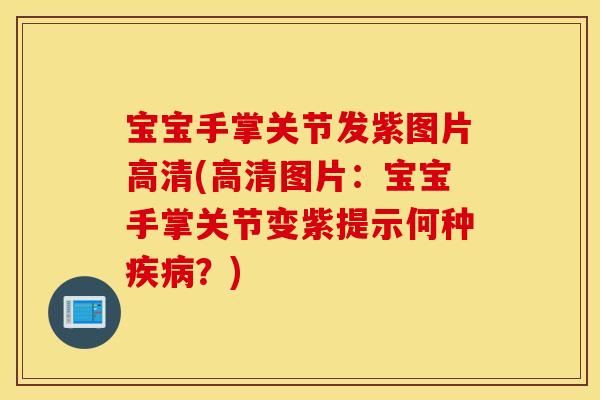 宝宝手掌关节发紫图片高清(高清图片:宝宝手掌关节变紫提示何种疾病?) 宝宝手掌关节发紫图片高清(高清图片:宝宝手掌关节变紫提示何种疾病?)