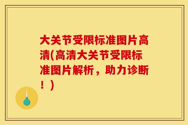 大关节受限标准图片高清(高清大关节受限标准图片解析，助力诊断！)