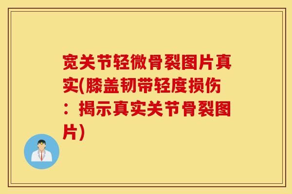 宽关节轻微骨裂图片真实(膝盖韧带轻度损伤：揭示真实关节骨裂图片)
