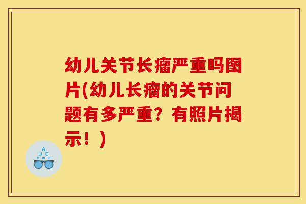 幼儿关节长瘤严重吗图片(幼儿长瘤的关节问题有多严重？有照片揭示！)