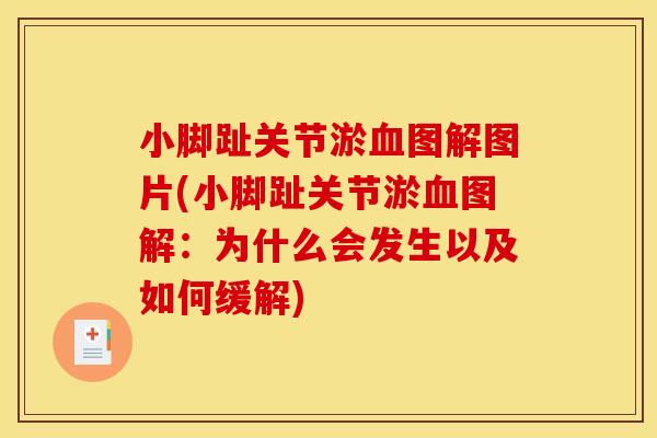 小脚趾关节淤血图解图片(小脚趾关节淤血图解：为什么会发生以及如何缓解)