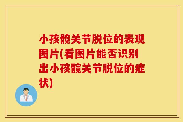 小孩髋关节脱位的表现图片(看图片能否识别出小孩髋关节脱位的症状)