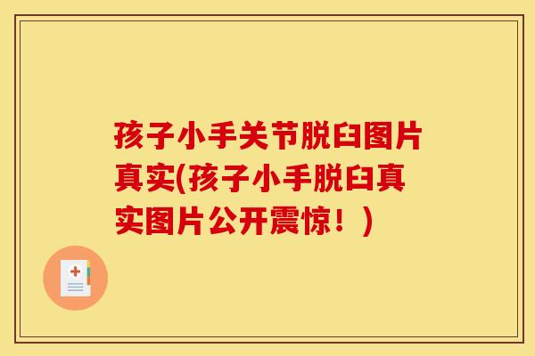 孩子小手关节脱臼图片真实(孩子小手脱臼真实图片公开震惊!) 孩子小手关节脱臼图片真实(孩子小手脱臼真实图片公开震惊!)