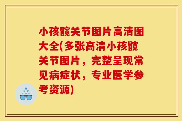 小孩髋关节图片高清图大全(多张高清小孩髋关节图片，完整呈现常见病症状，专业医学参考资源)
