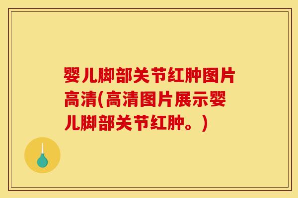 婴儿脚部关节红肿图片高清(高清图片展示婴儿脚部关节红肿。)