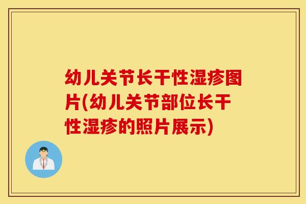 幼儿关节长干性湿疹图片(幼儿关节部位长干性湿疹的照片展示)