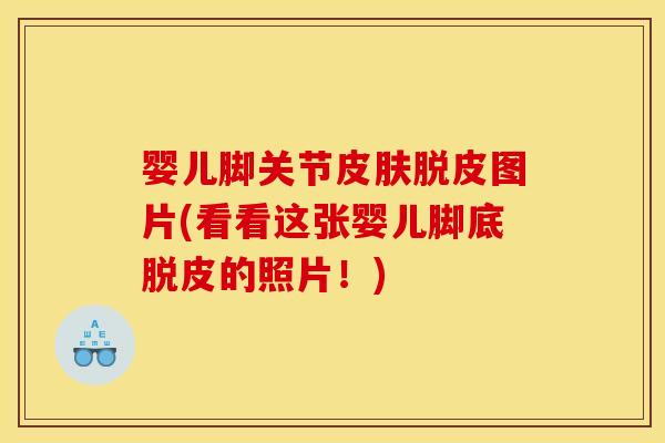 婴儿脚关节皮肤脱皮图片(看看这张婴儿脚底脱皮的照片！)