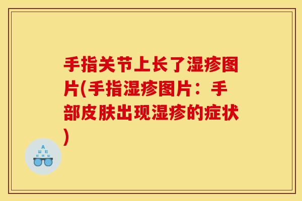 手指关节上长了湿疹图片(手指湿疹图片：手部皮肤出现湿疹的症状)