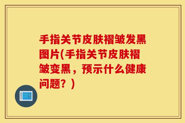 手指关节皮肤褶皱发黑图片(手指关节皮肤褶皱变黑，预示什么健康问题？)