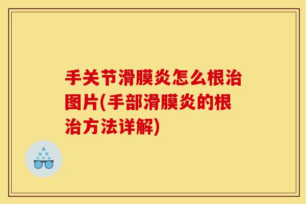 手关节滑膜炎怎么根治图片(手部滑膜炎的根治方法详解) 手关节滑膜炎怎么根治图片(手部滑膜炎的根治方法详解)